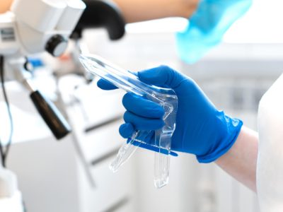 Estudio de colposcopia para revisar el cuello uterino en Monterrey
